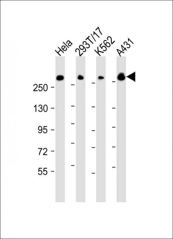 FLNB / TAP Antibody (aa163-196)