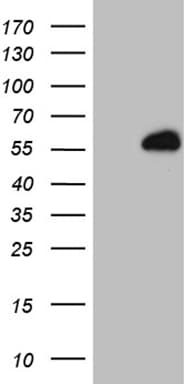 Monoclonal Mouse anti-Human RING1 Antibody (clone OTI6F11, aa88-362, WB)