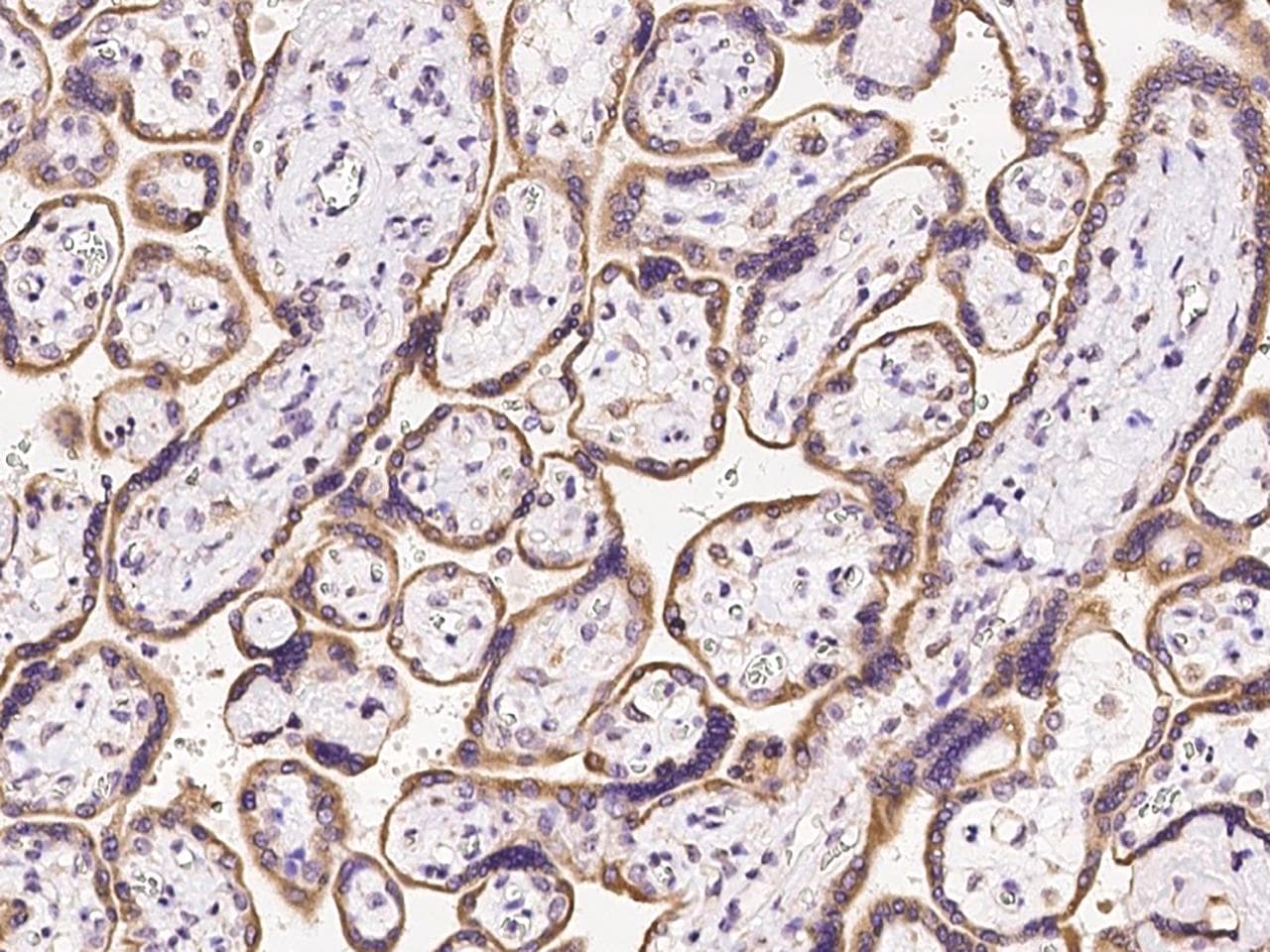 Polyclonal Rabbit anti-Human OS9 Antibody (IHC)