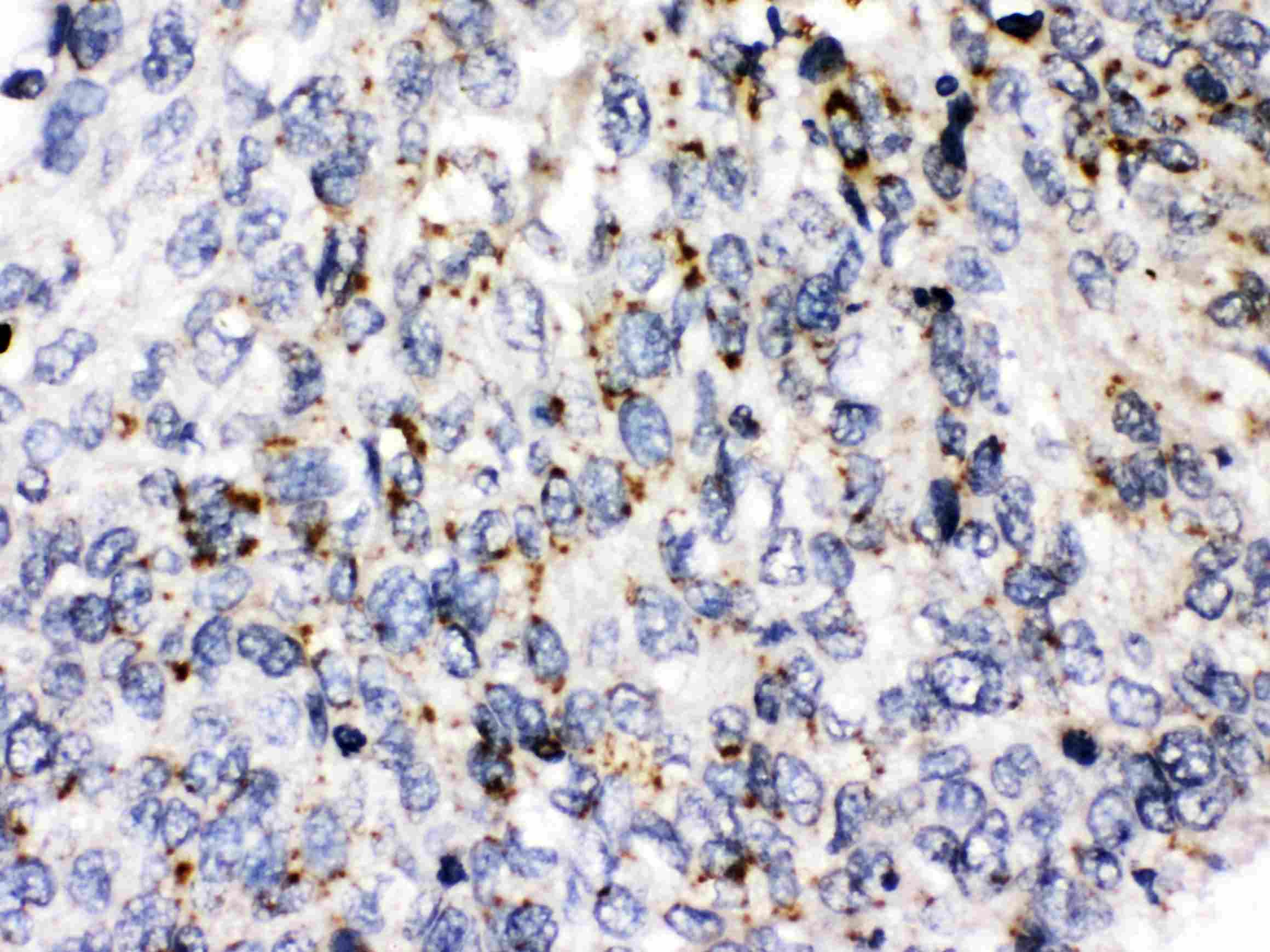 Polyclonal Rabbit anti-Human PLIN3 / M6PRBP1 / TIP47 Antibody (IHC, WB)
