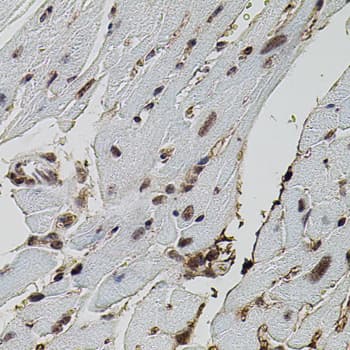 DAP-5 / EIF4G2 Antibody