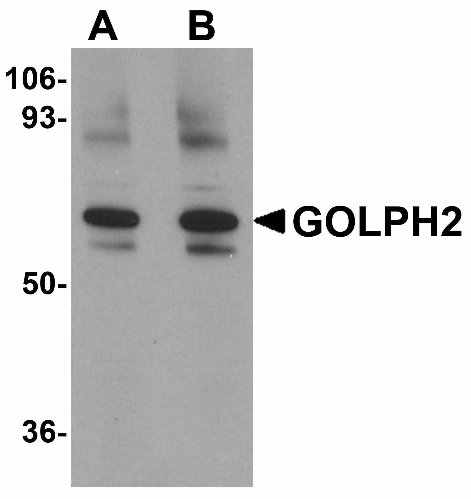 IHC-plus™ GOLM1 / GP73 / GOLPH2 Antibody