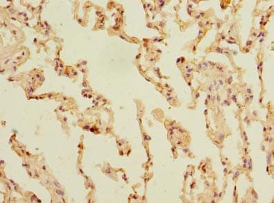 Polyclonal Rabbit anti-Human SLC23A3 Antibody (IHC)