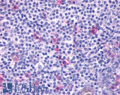 PathPlus™ Polyclonal Rabbit anti-Human CXCR4 Antibody (N-Terminus, IHC)