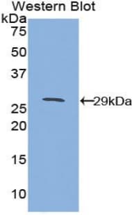 CD1D Antibody (aa56-271)