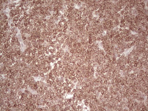 BCL2 / Bcl-2 Antibody (clone OTI4C1)