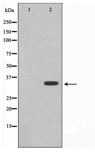 Polyclonal Rabbit anti-Human COX11 Antibody (WB)