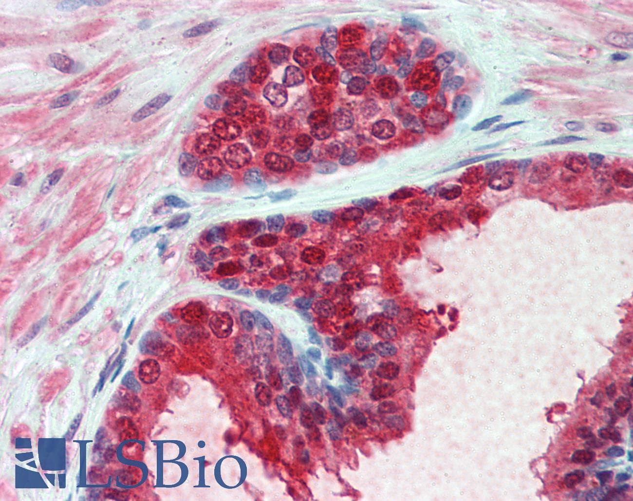 IHC-plus™ CMPK / CMPK1 Antibody (clone 1D7)