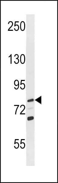 RECQ1 / RECQL Antibody (aa187-215)
