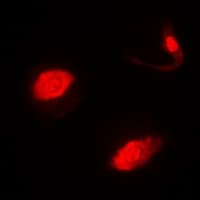 IHC-plus™ SUFU Antibody