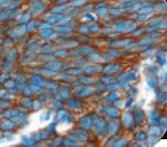 NCAM / CD56 Antibody (clone 123C3.D5, Ready-to-Use)