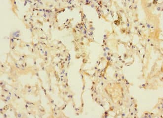 DUSP16 / MKP7 Antibody