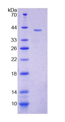 Mouse GANAB / Alpha Glucosidase II Protein (Recombinant His-T7, N-terminus)