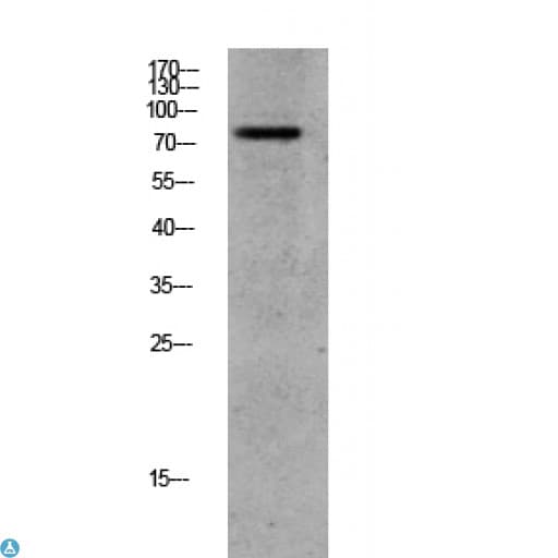 ADRBK1 / GRK2 Antibody (Ser685)