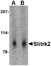 Polyclonal Rabbit anti-Human SLITRK2 Antibody (IHC, IF, WB)