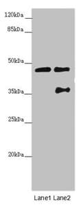 Polyclonal Rabbit anti-Human CEP44 / KIAA1712 Antibody (IHC, WB)