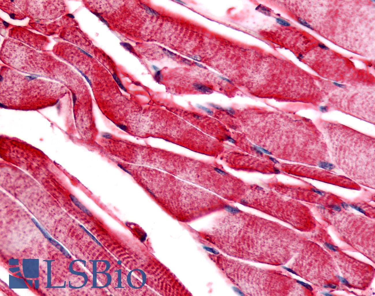 IHC-plus™ Polyclonal Rabbit anti-Human PYGM Antibody (C-Terminus, IHC)