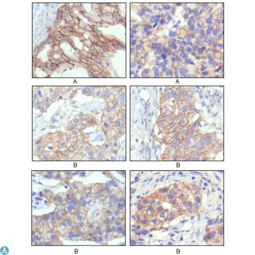 ERBB2 / HER2 Antibody