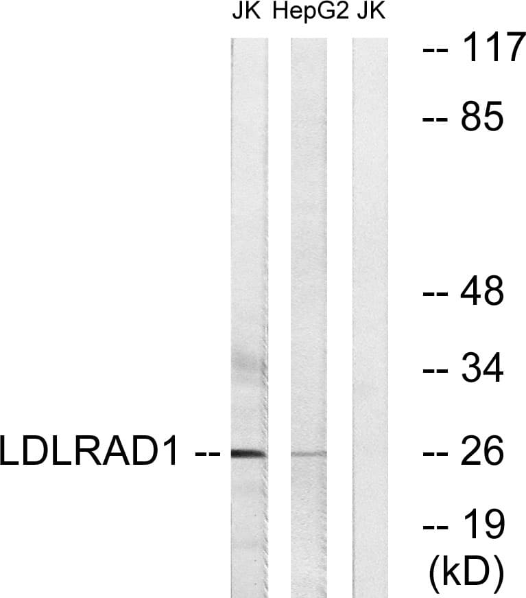 LDLRAD1 Antibody (aa84-133)