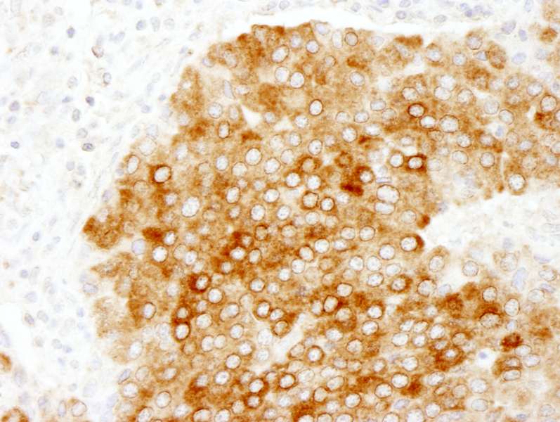 PBXIP1 / HPIP Antibody (aa1-50)