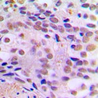 Polyclonal Rabbit anti-Human CREB1 / CREB Antibody (phospho-Ser121, IHC, WB)