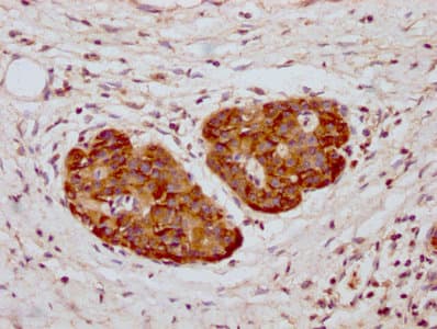 YWHAZ / 14-3-3 Zeta Antibody