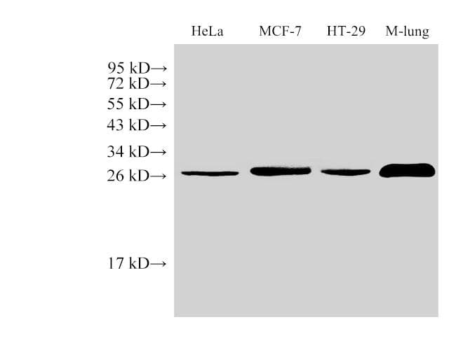 LGALS3 / Galectin 3 Antibody