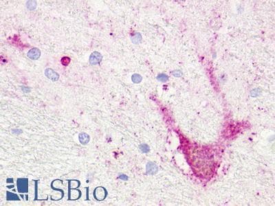 PathPlus™ TAAR5 Antibody (Extracellular Domain)