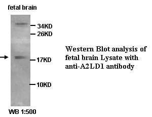 Polyclonal Rabbit anti-Human A2LD1 Antibody (WB)