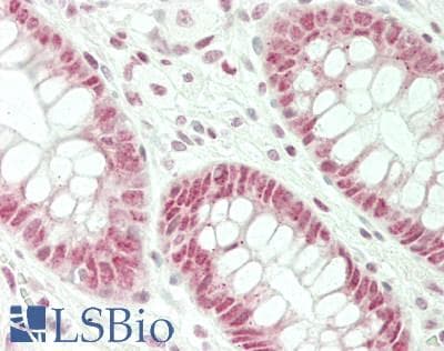 IHC-plus™ HES6 Antibody (aa6-55)