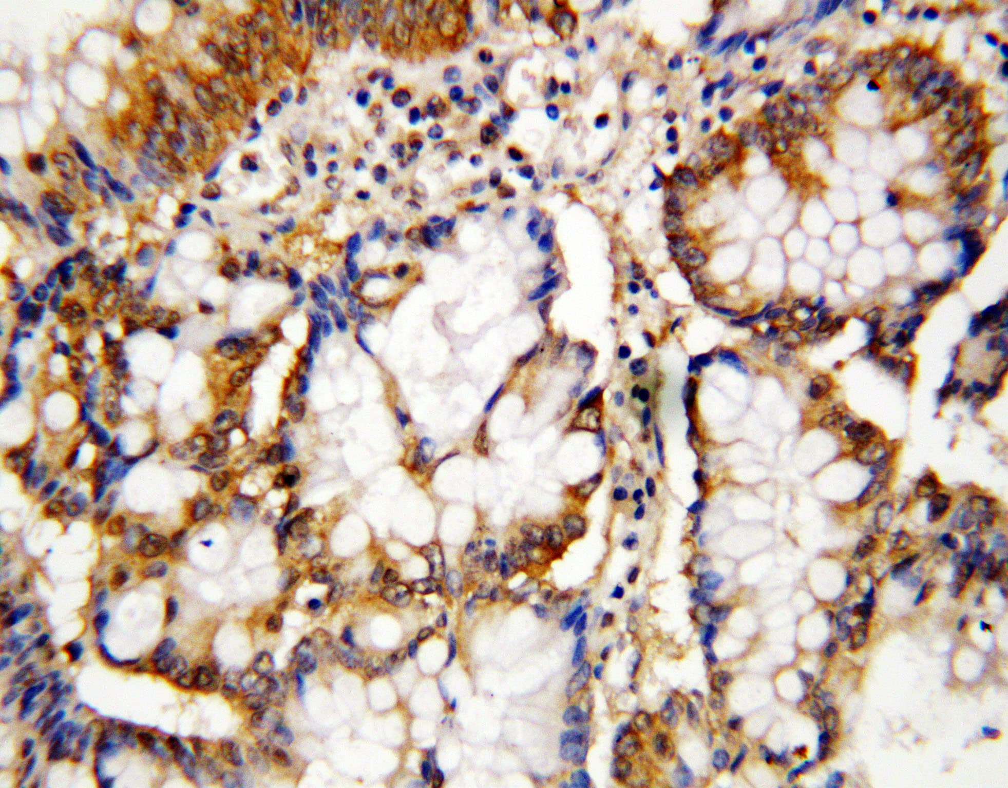 CASP10 / Caspase 10 Antibody (aa220-236)