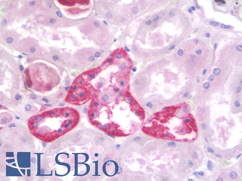 POLR3E / SIN Antibody (aa191-240)