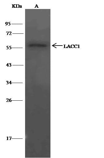 LACC1 Antibody (Preservative Free)