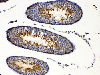 Polyclonal Rabbit anti-Human PRKAR1A Antibody (IHC, WB)