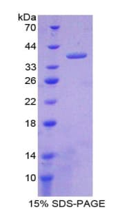 Rat Nesfatin-1 Protein (Recombinant His-GST)