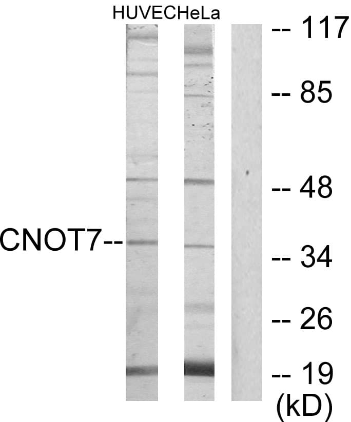 CNOT7 Antibody (aa10-59)