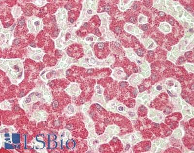 IHC-plus™ Neurofibromin / NF1 Antibody (aa2760-C-term)