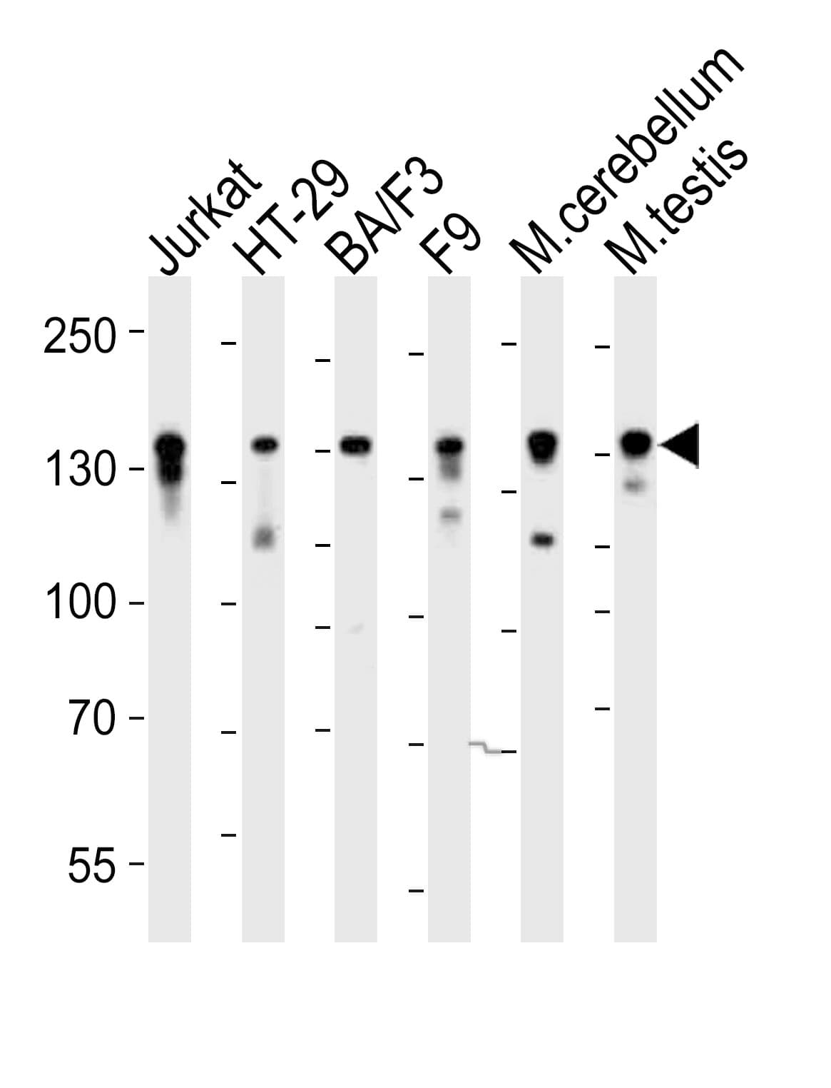 Polyclonal Rabbit anti-Mouse CTR9 Antibody (aa1022-1056, IHC, IF, WB)