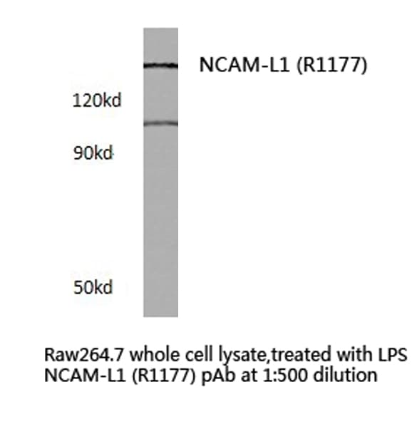 Polyclonal Rabbit anti-Human L1CAM Antibody (Arg1177, IHC, IF, WB)