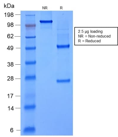 PathPlus™ FOXA1 Antibody (aa372-472, clone rFOXA1/1515)