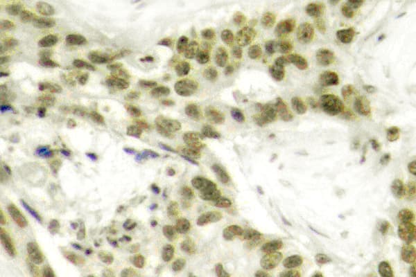 AR / Androgen Receptor Antibody (phospho-Ser213)