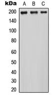 Polyclonal Rabbit anti-Human CDC42BPA / MRCK Antibody (Internal, WB)