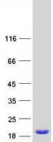 Human RBP5 Protein (Recombinant Myc-DDK (Flag))