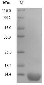 Human PLIN4 / S3-12 Protein (Recombinant 6His, N-terminus)
