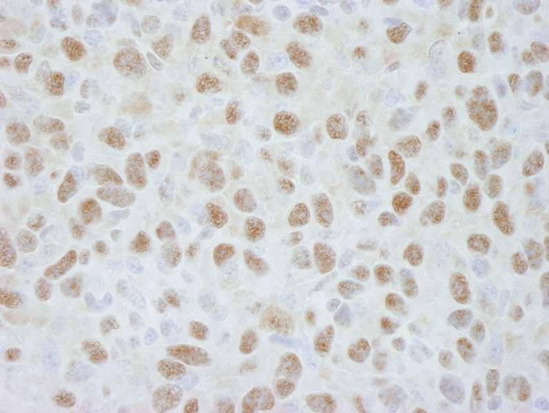 Polyclonal Rabbit anti-Human DDB1 Antibody (aa1100-C-term, IHC)