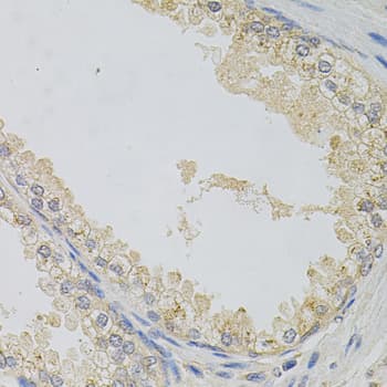Alpha SNAP Antibody (AP)