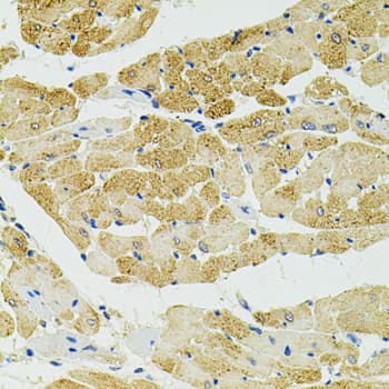 Polyclonal Rabbit anti-Human RIP1 / RALBP1 Antibody (IHC, WB)