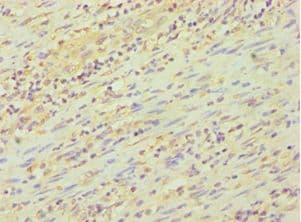 FKBP4 / FKBP52 Antibody (aa220-459)
