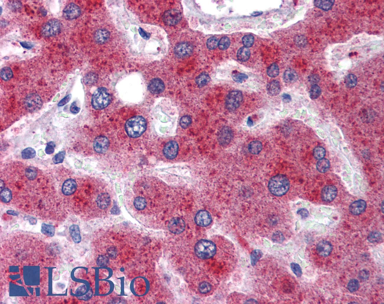 Polyclonal Rabbit anti-Human MTHFD1 Antibody (aa74-123, IHC, WB)