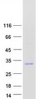 Human FGFBP2 Protein (Recombinant Myc-DDK (Flag))